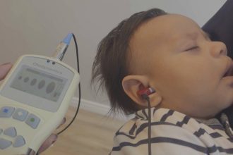 Teste de audição em bebê com equipamento Otodynamics, fones no ouvido e tela com resultados.
