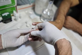 Amazonas registra redução de 20,7% na mortalidade por Aids