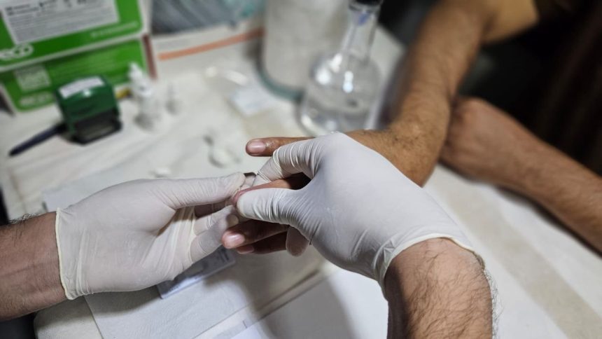 Amazonas registra redução de 20,7% na mortalidade por Aids