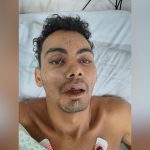 Hospital João Lúcio procura familiares de paciente que sofreu queda de cinco metros de altura