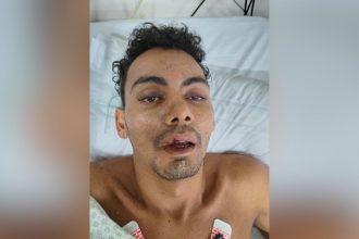 Hospital João Lúcio procura familiares de paciente que sofreu queda de cinco metros de altura