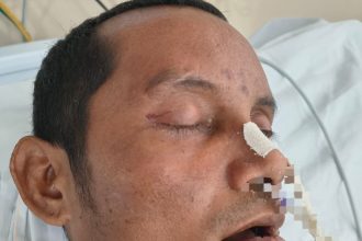 Hospital João Lúcio busca por familiares de paciente internado