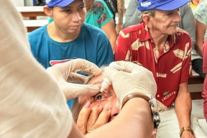 Mutirão de cirurgias de catarata atende pacientes em Parintins