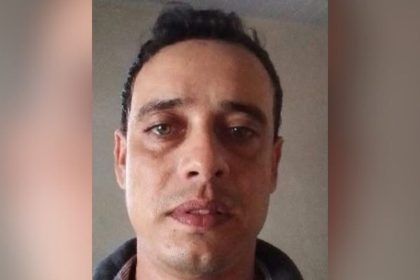 Polícia procura suspeito de tentar matar companheira em Manaus; vítima foi brutalmente agredida