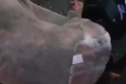 Passageira de moto por aplicativo fica gravemente ferida após colisão em Manaus