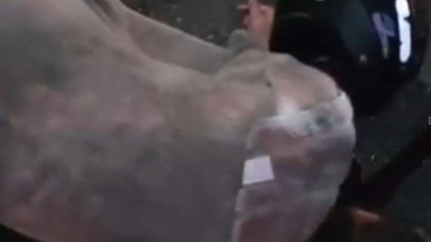 Passageira de moto por aplicativo fica gravemente ferida após colisão em Manaus