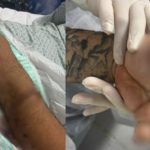 Motorista de app tem dedo amputado após ser atacado por passageiro com terçado e pitbull em Manaus