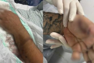 Motorista de app tem dedo amputado após ser atacado por passageiro com terçado e pitbull em Manaus