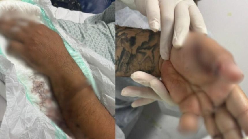 Motorista de app tem dedo amputado após ser atacado por passageiro com terçado e pitbull em Manaus