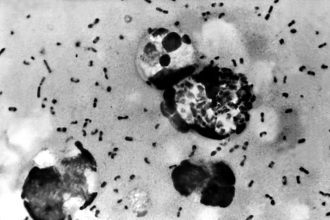 Doenças da Idade Média continuam circulando e fazendo vítimas