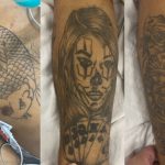 Hospital João Lúcio busca por família de paciente em estado grave