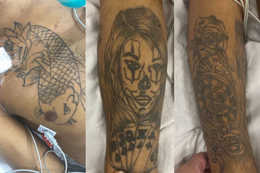 Hospital João Lúcio busca por família de paciente em estado grave