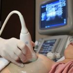 Confira como agendar ultrassom de mama gratuita em Manaus