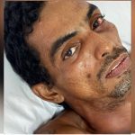 Hospital João Lúcio busca familiares de homem vítima de choque elétrico