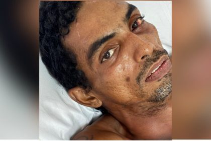 Hospital João Lúcio busca familiares de homem vítima de choque elétrico