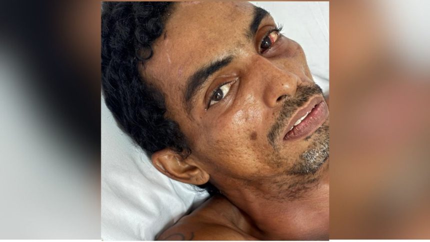 Hospital João Lúcio busca familiares de homem vítima de choque elétrico