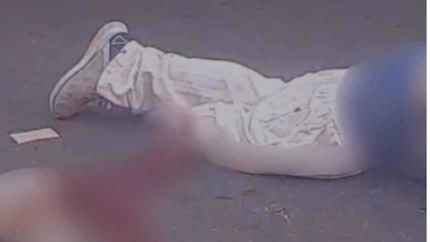 Motociclista tem perna amputada em acidente na zona oeste de Manaus