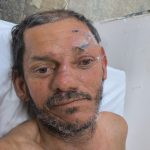 Homem atropelado por moto aguarda família em hospital de Manaus