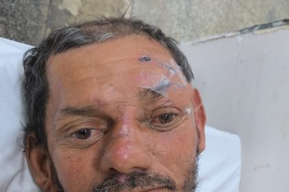 Homem atropelado por moto aguarda família em hospital de Manaus