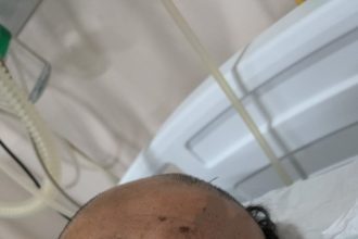 Hospital João Lúcio procura familiares de vítima de agressão física