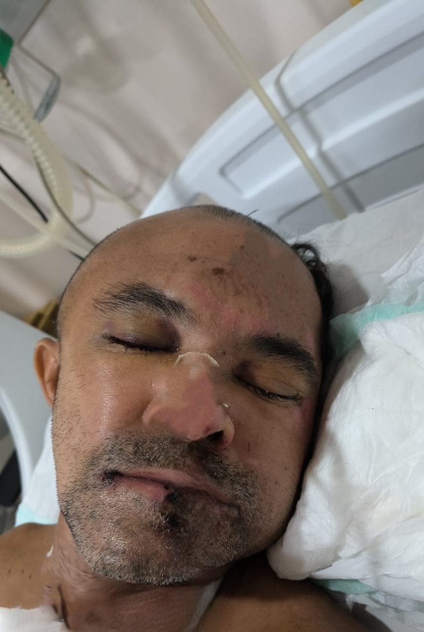 Hospital João Lúcio procura familiares de vítima de agressão física