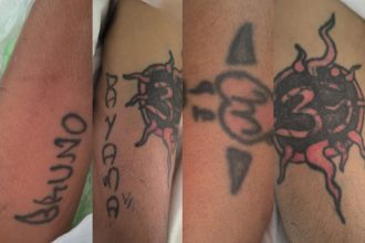 Hospital João Lúcio busca familiares de paciente sem identificação