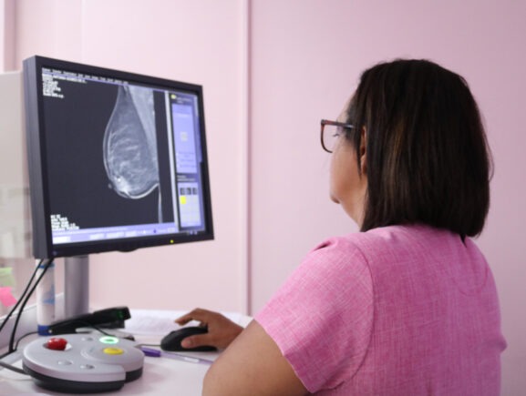 Circuito oferece prevenção e diagnóstico do câncer de mama
