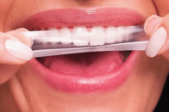 Fitas de clareamento dental estão proibidas pela Anvisa