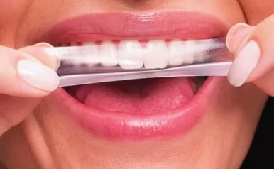 Fitas de clareamento dental estão proibidas pela Anvisa