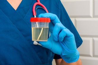 O que cor da urina revela sobre saúde e quando buscar um médico