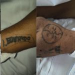 Hospital João Lúcio busca familiares de paciente sem identificação