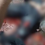 Motociclista tem perna esmagada após colisão com carro em Manaus