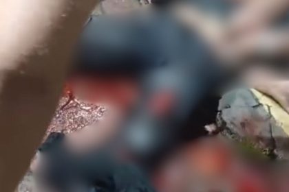 Motociclista tem perna esmagada após colisão com carro em Manaus