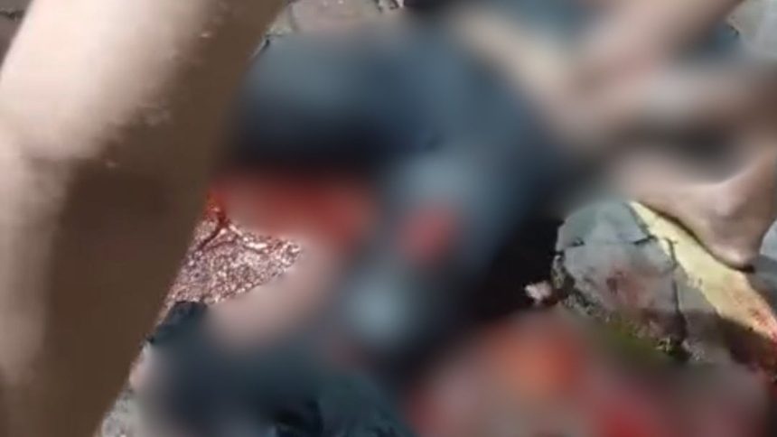 Motociclista tem perna esmagada após colisão com carro em Manaus