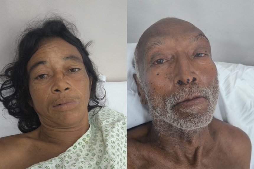 Pacientes no Hospital João Lúcio sem acompanhamento
