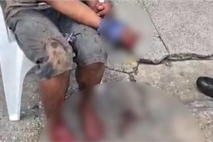 Homem tem dedos cortados após suposta tentativa de assalto na Compensa