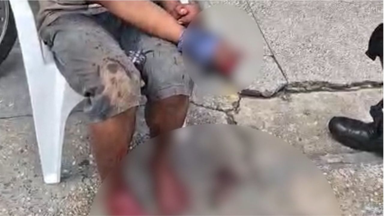 Homem tem dedos cortados após suposta tentativa de assalto na Compensa